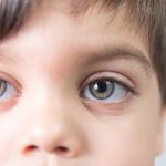 Câncer ocular infantil causa “olhos de gato” e pode provocar cegueira