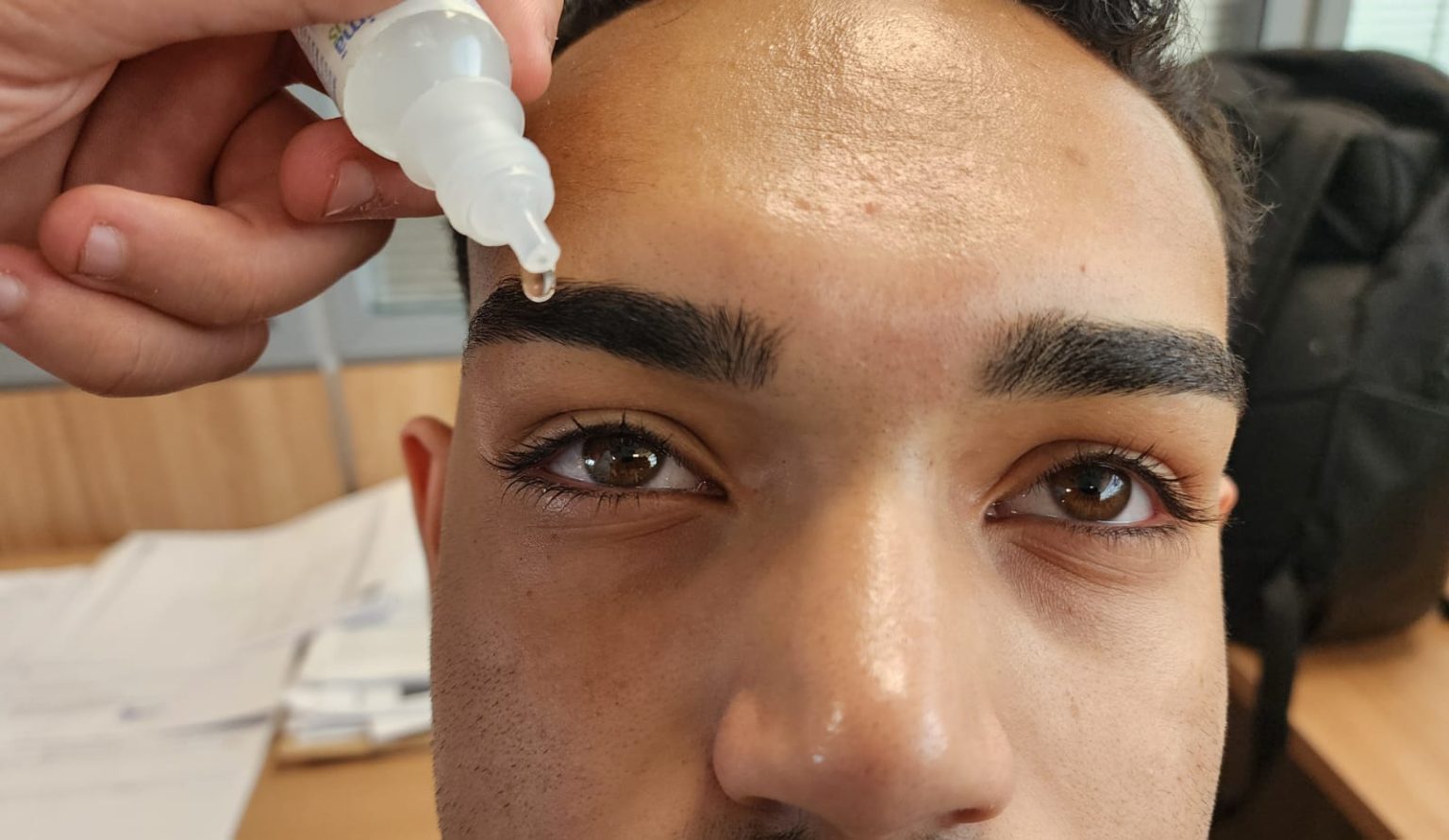 Ressecamento ocular de pode gerar infecção grave e perda da visão